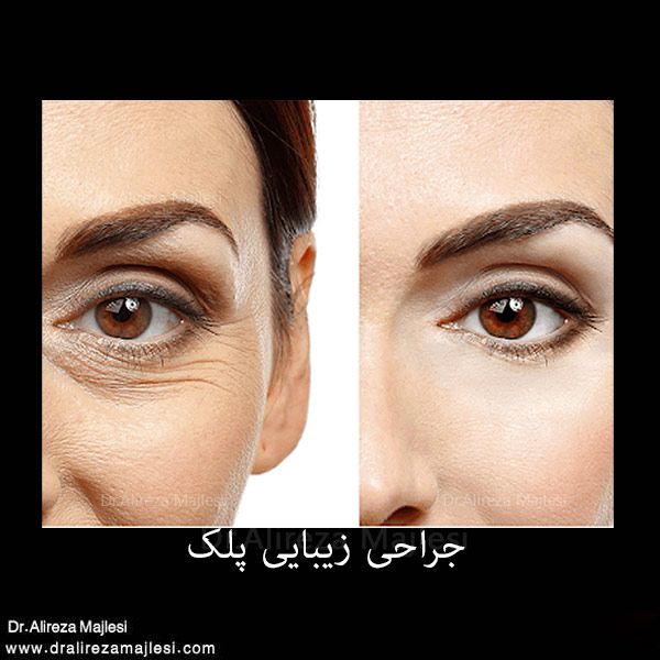 پیش به سوی زیبایی