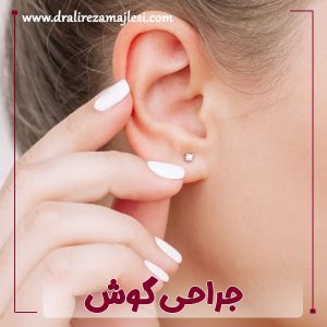 جراحی گوش در اصفهان - دکتر علیرضا مجلسی