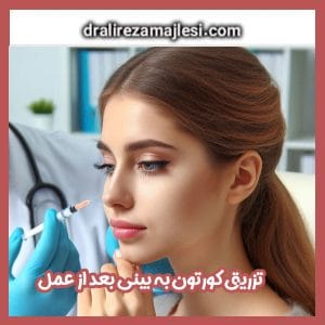 تزریق کورتون به بینی بعد از عمل - دکتر مجلسی - dralirezamajlesi.com