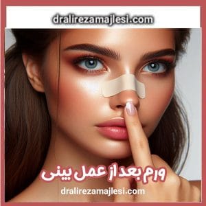 ورم بعد از عمل بینی - دکتر مجلسی -dralirezamajlesi.com