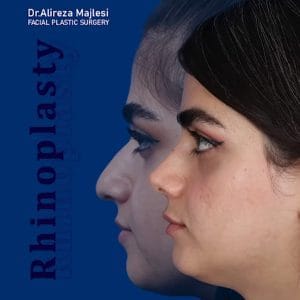 جراحی بینی گوشتی - دکتر مجلسی -
