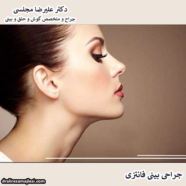 جراحی بینی فانتزی